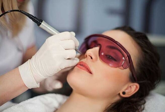 Laser Biorevitalizazioa